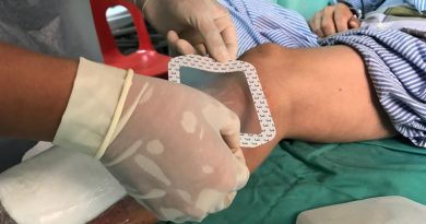 Откритие на американски научници: Лек за притисок уништува бактерија отпорна на антибиотици